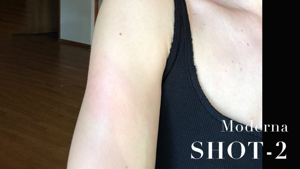 Side effect after the Modern vaccine